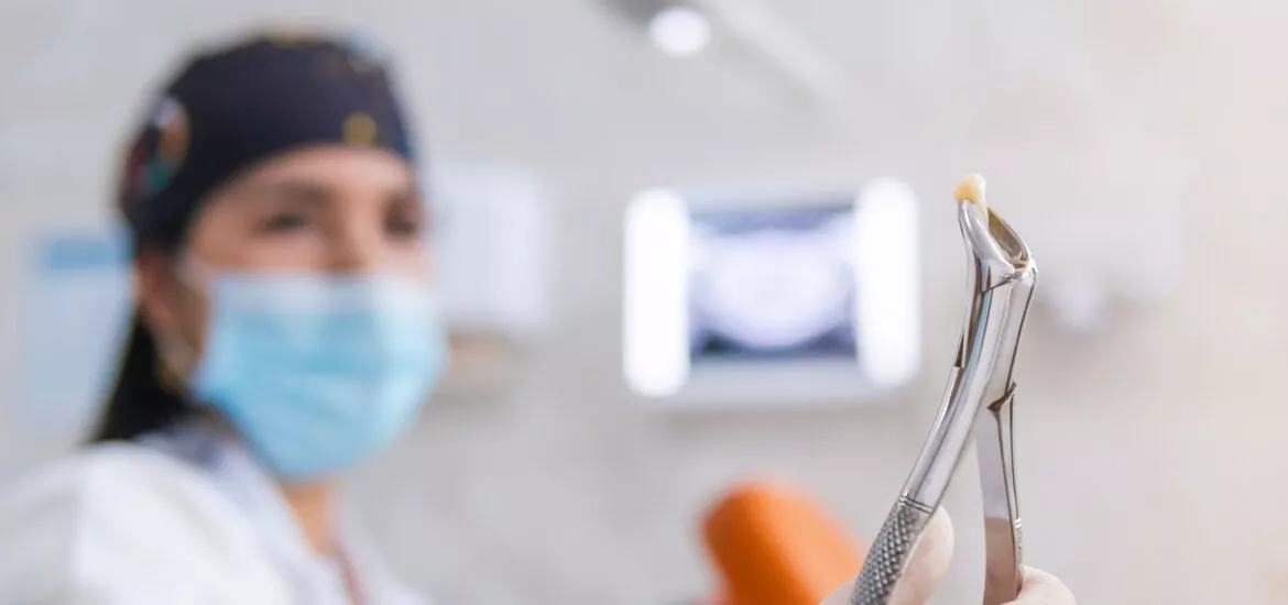 doctor holding up an extracted tooth